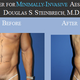 Image for article titled The Manly World of Manly Plastic Surgery for Manly Men